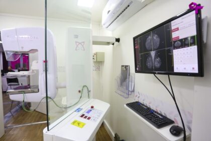 Carretas de Mamografia oferecem exames gratuitos em cinco municípios de SP