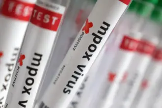 Número de casos de Mpox no Brasil chega a 140 em 2026