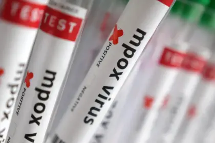 Número de casos de Mpox no Brasil chega a 140 em 2026