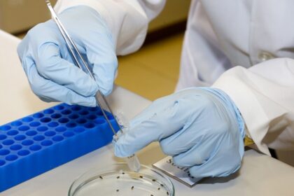 Pesquisadores da USP identificam biomarcador que pode prever complicações da hepatite