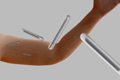 Projeto de Lei proíbe implantes hormonais para fins estéticos