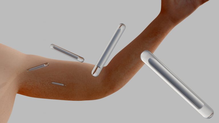 Projeto de Lei proíbe implantes hormonais para fins estéticos